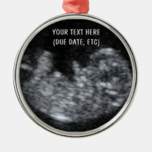 Custom Baby Ultrasound Photo Christmas Ornaments