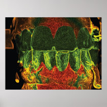 Dental art poster