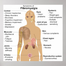 Diagramme des symptômes de la fibromyalgie posters
