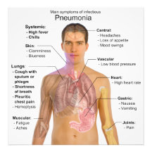 Diagramme des symptômes de la pneumonie photo d’art
