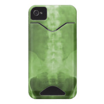Digital X-Ray Art Case-Mate ID™ iPhone 4 Case
