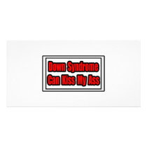 Down Syndrome Can Kiss My Ass