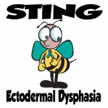 Dysphasie ectodermique de STING Photo Sculptures