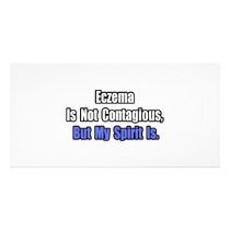 Eczema Is Not Contagious..