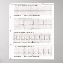 ekg Rhythms Posters