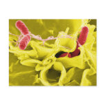 Electron Micrograph Showing Salmonella Typhimurium Post Cards