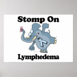 Elephant Stomp On Lymphedema
