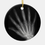Extra Digit X-ray Left Hand Ornament