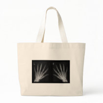 Extra Digit X-ray Right & Left Hands Canvas Bag