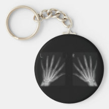 Extra Digit X-ray Right & Left Hands Key Chain
