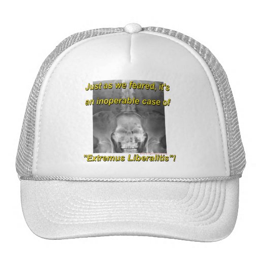 Extremus Liberalitis Hat