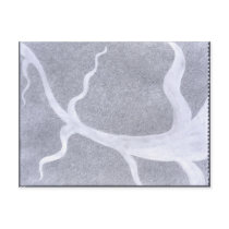 eyevein post card