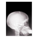 Foot in Mouth X-Ray Post Card