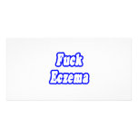 Fuck Eczema Photo Card