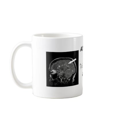 Get Personal With Your Lesion Load! Mugs by Baitulos