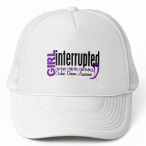 Girl Interrupted 1 Crohn's Disease