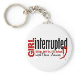 Girl Interrupted 1 Heart Disease