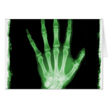 Green X-ray Skeleton Hand Greeting Cards