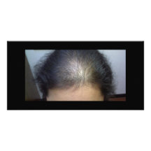 Hair T Photo Greeting Card