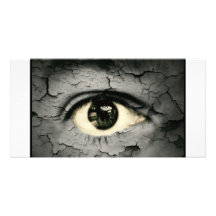 Human eye serrounded by Peeling skin Picture Card