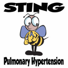 Hypertension pulmonaire de STING Photo Sculpture