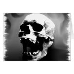 Hysteriskull riant le crâne humain cartes de vœux