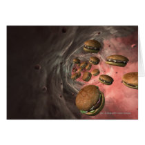 Illustration of a blood vessel with burgers cards