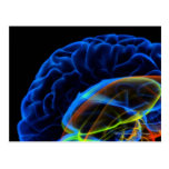 Image de rayon X du cerveau Cartes Postales