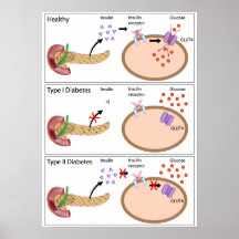 Insulin action and diabetes type 1 and 2 Poster