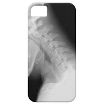 Jaw and Spine X Ray IPhone Case iPhone 5 Cover