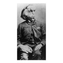 Joseph "John" Merrick The Elephant Man from 1889 Photo Cards