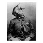 Joseph "John" Merrick The Elephant Man from 1889 postcards