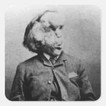 Joseph "John" Merrick The Elephant Man from 1889 Sticker