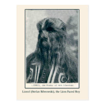 Lionel, the Lion Faced Boy Cards and Postcards