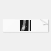 Lower Extremities-Ankle AP-5_20_2010-12_55_54 PM-1 Bumper Stickers
