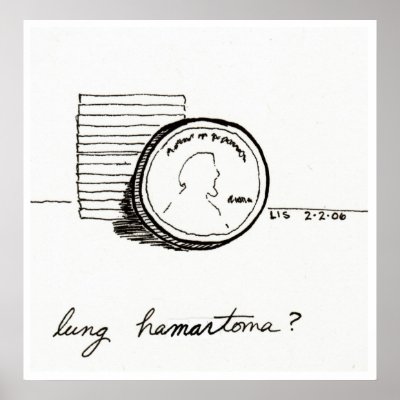 Lung Hamartoma print by bio_muse