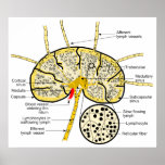 Lymph Node Showing Flow of Lymph to Lymph Sinuses Posters