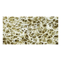 Magnified Porous Texture from the Human Hip Bone Customized Photo Card