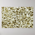 Magnified Porous Texture from the Human Hip Bone Print
