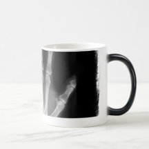 Main de squelette de rayon X de B&W Mug À Café