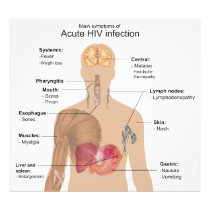 Main Symptoms of Acute HIV Infection Art Photo