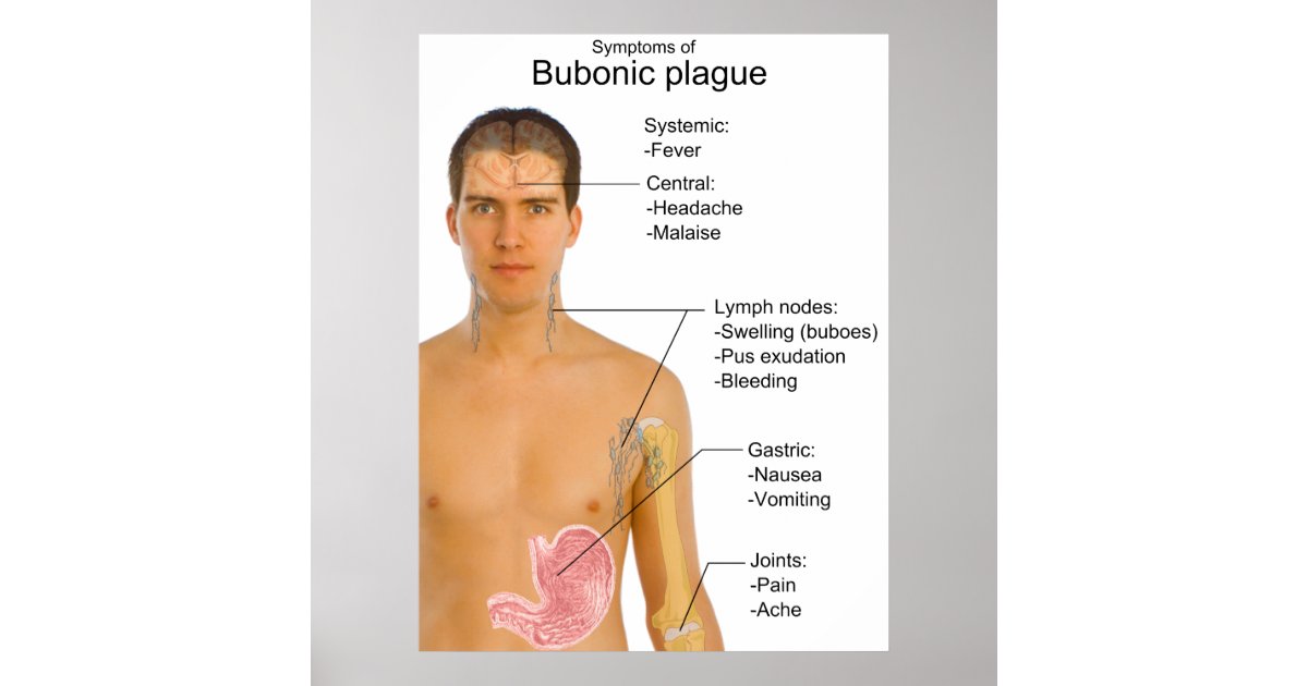 Main Symptoms of Black Death Bubonic Plague Chart Poster Zazzle