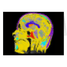 Mark's colorized MRI Cards