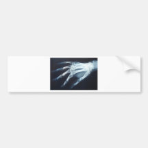 Medical X Ray Imaging Hand Fingers Bumper Stickers