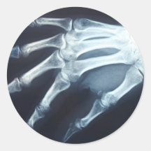 Medical X Ray Imaging Hand Fingers Round Stickers