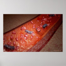 Microscopic rendering of a blood infection poster
