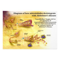 Microtubules Desintegration in Alzheimer's Disease Photograph