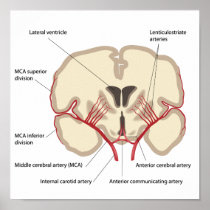Middle cerebral artery  Poster