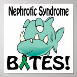 Nephrotic Syndrome BITES posters