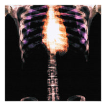 NERVURES SQUELETTIQUES DE TORSE DE RAYON X - ORIGI INVITATIONS PERSONNALISÉES